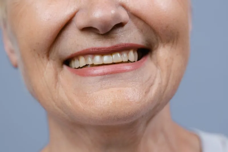 A patient smiling after treatment